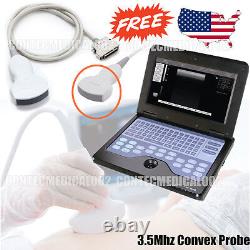 Digital Portable Ultrasound Scanner Laptop Machine with 3.5Mhz Convex probe, USA