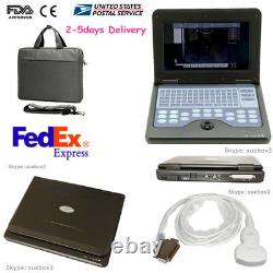 Digital Portable laptop machine Digital Ultrasound scanner+3.5 Convex probe NEW