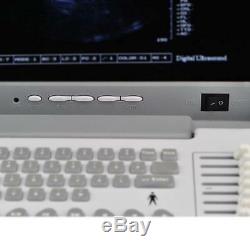 Digital Scan Ultrasound Scanner Machine+3 probes CONVEX, LINEAR, TV+3D Equipment