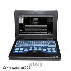 Digital Ultrasound Scanner Laptop Machine 4 Probes Convex/Cardiac/Linear/Vaginal