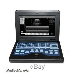 Digital Ultrasound Scanner Laptop Machine Diagnostic Systems 3.5Mhz Convex Probe