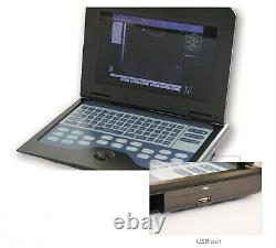 Digital Ultrasound Scanner with 7.5MHz Linear Probe Laptop B-Ultrasound Machine