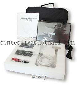 Digital laptop ultrasound scanner machine 7.5mhz linear probe small organ check