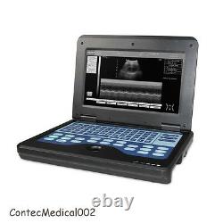 Digital ultrasound scanner Portable laptop machine 2 probes Convex/Cardiac, USA