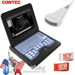 FDA CE CONTEC Portable Ultrasound Scanner Digital Laptop Machine, 3.5Mhz Convex
