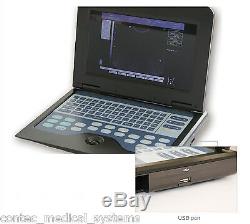 FDA&CE CONTEC Portable Ultrasound Scanner Laptop Machine, 7.5MHz Linear Probe, NEW
