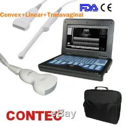 FDA&CE Portable Laptop Ultrasound Scanner Digital Machine Human 3 Probes CONTEC