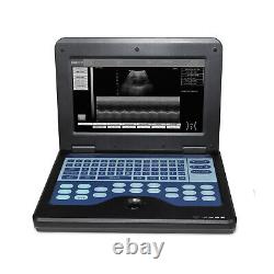 FDA&CE Portable Ultrasound Scanner Laptop Machine with Convex and Linear 2 Probe
