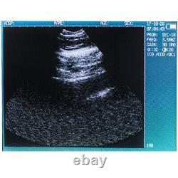 FDA CE Veterinary Portable Handheld Digital Ultrasound Scanner with 3.5MHz Probe
