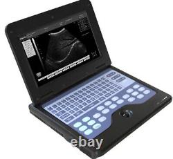 FDA CMS600P2 Portable Ultrasound Scanner Digital Laptop Machine, 3.5Mhz Convex