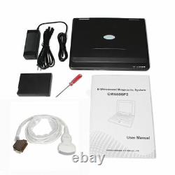 FDA Digital Portable Ultrasound Machine Laptop Scanner with 3.5Mhz Convex Probe