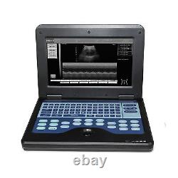 FDA Full digital ultrasound laptop machine scanner 3.5M convex+6.5M tranvaginal