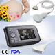 Fda Handheld Full Digital Ultrasound Scanner Machine Handscan Convex Probe Human