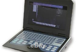 FDA, Human Digital Laptop Ultrasound Scanner Medical System+3.5M Convex Probe, USA