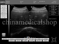 FDA Portable Ultrasound Scanner 10.1 inch 2 probes medical ultrasonic machine US