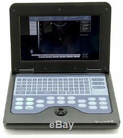 Full Digital Laptop/portable notebook B-Ultrasound Scanner/Machine System+Convex
