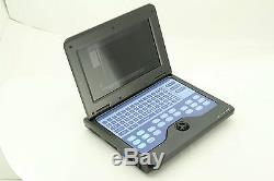 Full Digital Laptop/portable notebook Ultrasound Scanner/Machine System+Convex
