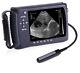 Full Digital Palmtop Bladder Ultrasound Scanner Color Machine With Convex Probe