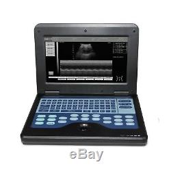 Full Digital Ultrasound Scanner Laptop Machine+ 3.5 Convex+ 7.5 Linear 2 probes