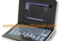 Full Digital Ultrasound Scanner laptop Machine, 3.5 convex probe, abdomen, CE