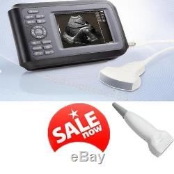 Handheld 5.5''Color Digital Ultrasound Scanner with Convex Linear for Human Test