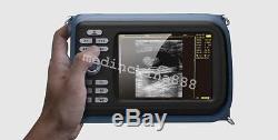 Handheld 5.5''Color Digital Ultrasound Scanner with Convex Linear for Human Test