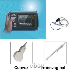 Handheld 5.5 LCD Digital Ultrasound Scanner Convex+6.5MHz Transvaginal Probe US