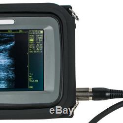 Handheld 5.5inch Ultrasound Scanner Digital 6.5 Vaginal+ Micro-convex Probes CE