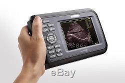 Handheld Color Digital Ultrasound Ultrasonic Scanner Convex Transvaginal Medical
