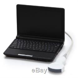 Handheld Digital Laptop Machine Portable Ultrasound Scanner 3.5MHz Convex probe
