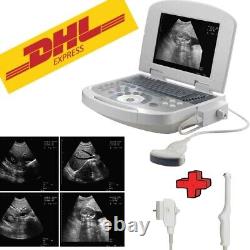 Handheld Digital Ultrasound Machine Medical Convex Probe+Transvaginal Probe