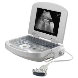 Handheld Digital Ultrasound Machine Medical Convex Probe+Transvaginal Probe