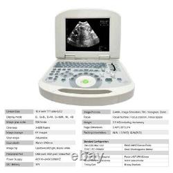 Handheld Digital Ultrasound Machine Medical Convex Probe+Ultrasound Linear Probe