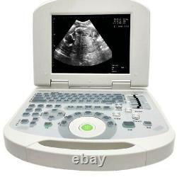 Handheld Digital Ultrasound Machine Medical Convex Probe+Ultrasound Linear Probe