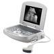 Handheld Digital Ultrasound Machine For Medical Use Convex Probe