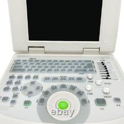 Handheld Digital Ultrasound Machine for Medical Use Convex Probe