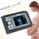 Handheld Digital Ultrasound Scanner Machine+transvaginal Probe 80 Element Ce/fda