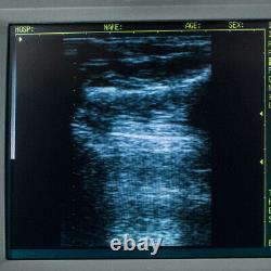 Handheld Digital Ultrasound Scanner Machine+Transvaginal Probe 80 Element CE/FDA
