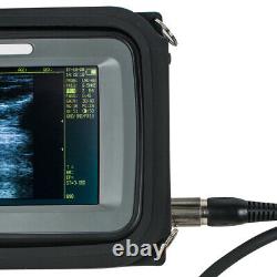 Handheld Digital Ultrasound Scanner Machine +Transvaginal Probe Health Care Use