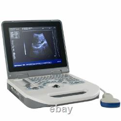 Handheld Medical 12.1 Digital ultrasound Ultrasound Scanner 3.5Mhz Convex Probe