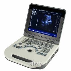Handheld Medical 12.1 Digital ultrasound Ultrasound Scanner 3.5Mhz Convex Probe