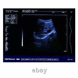 Handheld Medical 12.1 Digital ultrasound Ultrasound Scanner 3.5Mhz Convex Probe