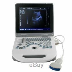 Handheld Notebook Full Digital Ultrasound Scanner Diagnostic System Convex Probe
