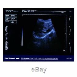 Handheld Notebook Full Digital Ultrasound Scanner Diagnostic System Convex Probe