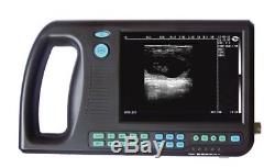 Handheld Portable Full Digital Ultrasound Scanner Machine Free 7.5M Linear Probe