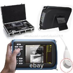 Handheld Portable Machine Ultrasound Scanner Cardiac Micro-Convex Probe Carejoy