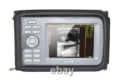 Handheld Portable Machine Ultrasound Scanner Cardiac Micro-Convex Probe Carejoy