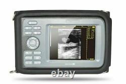 Handheld Ultrasound Scanner Digital Machine +Convex/Abdominal Probe & Box