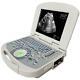Handheld Ultrasound Scanner High-res Imaging Portable Digital