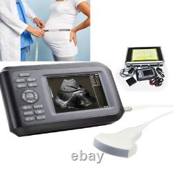 Handheld Ultrasound Scanner Machine Digital+Convex Probe For Human Carejoy